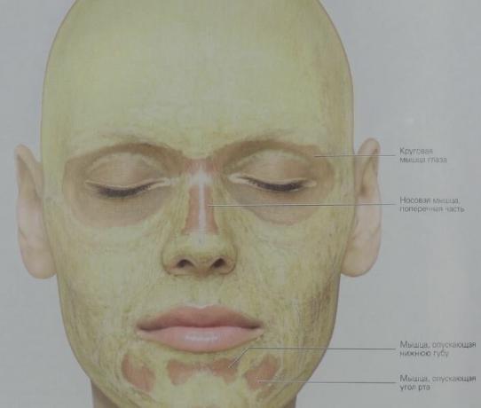 Štai kaip poodinių riebalų yra platinamas mūsų veido (geltona). Be žiedinių raumenų akių sluoksnio jungiamajame audinyje yra beveik nėra riebalų