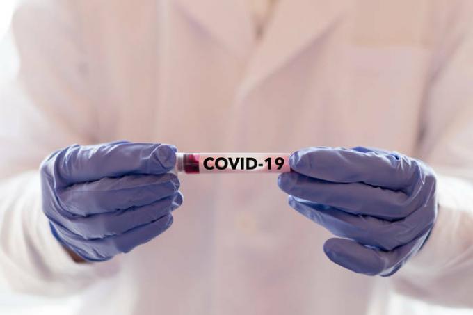 Patvirtintas naujas koronaviruso infekcijos būdas