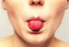 Vėžys liežuvio: įspėjamieji ženklai