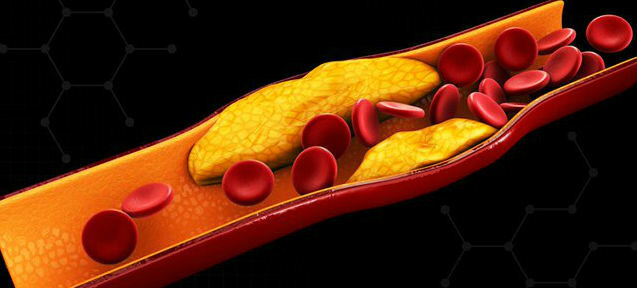 Cholesterolis - cholesterinas