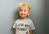 Kiaulpienės vaikas: kas yra nešukuojamų plaukų sindromas?