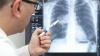 Gydytojas palygina spinduliuotės poveikį su plaučių kompiuterine tomografija ir radiacija Hirosimoje