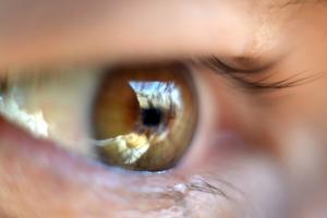 Tinklainės atšoka akys: kaip išsaugoti regėjimą?