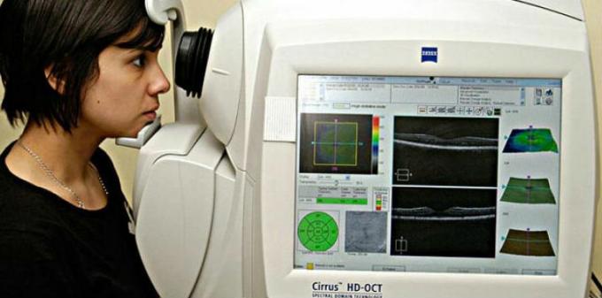 Optinis darna tomografijos angiografija