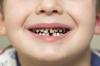 Kaip sustabdyti pieninių dantų ėduonį - odontologo patarimai
