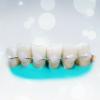 Lankytinos danties dantys: kiek tai efektyviai?