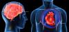 Širdies priepuolio ir insulto: 7 pagrindiniai klaidų, kad jie sukelia