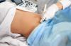 Kaip dažnai nėštumo metu reikia atlikti ultragarsą, sako gydytojas