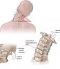 4 pagrindiniai pratimai stuburo padės pamiršti apie skausmą ir osteochondrozės!