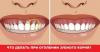 Kaip gydyti dantenas, kai dantys tampa plikas kaklas?